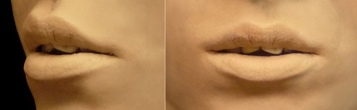 padova dettaglio bocca.jpg