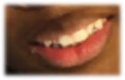Teeth hospitalized girl MD.jpg