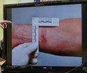 Injury1.JPG