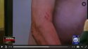 Injury6.JPG