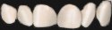 Hillsboro JD Teeth.jpg