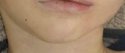 boybluechin.jpg
