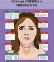 Signs & symptoms of strangulation.JPG
