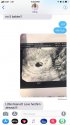 2018.6.19 SW FB ultrasound.jpg