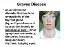 Graves+Disease.jpg