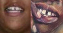 minot-jones and butts county GA UID teeth.png