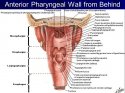 c5 Pharyngeal Wall from behind.jpg