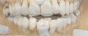 Teeth Sanibel Jane Doe.JPG