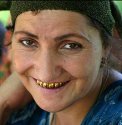 220px-Tajikistan_gold_teeth.jpg