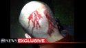 ht_george_zimmerman_head_dm_120419_wmain.jpeg