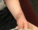 Romans left wrist.jpg