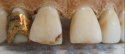 UP1483 teeth.jpg