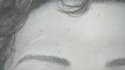 forehead scar.jpg