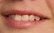 Brandi TEETH.jpg
