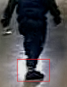 MB SP Lower Leg possible prosthetic 1.png