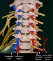 Drawing-shows-the-V2-segment-of-the-vertebral-artery-the-vertebral-venous-plexus-the.png