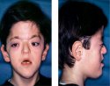 acrobrachycephaly-9420.jpg
