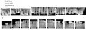 Dental_x-rays_1104191.jpg