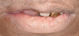 UP97570 tooth.png