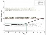 JonBenet abuse evidence (1).JPG