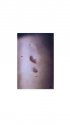 pellet puctures.jpg