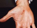 Cut-hand.jpg