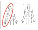 front-two-autopsy.jpg