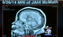 jahibrain.png