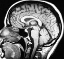 019852403ximaging-techniques1.jpg