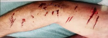 arm1a.jpg