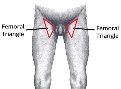 Femoral triangle.webp