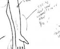 ws sandra bland arm diag autopsy report.JPG