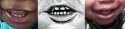 teeth 3-horz.jpg