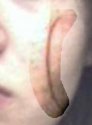 cheek.jpg