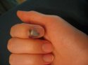 blood-under-the-nail.jpg