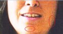 Capture-scars.jpg