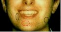 Capture-More Scars.jpg
