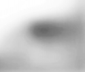 left eye after prying door.png
