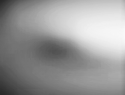 right eye 1.05C.png