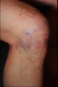 knee.jpg