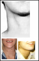 moles.PNG