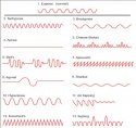 abnormal-breathing-patterns.jpg