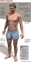 Henri's wounds.jpg