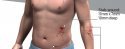 Henri's wounds large.jpg