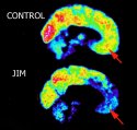 Brain scan for psychopathy.jpg