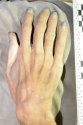 close up of right hand 1.jpg