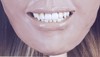 Gregg_CSO_color_teeth_front.jpg