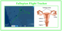 Falopian Flight Tracker 1.png