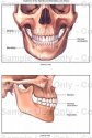 JAW BONE 3535W.jpg