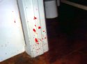 blood by toilet2.jpg